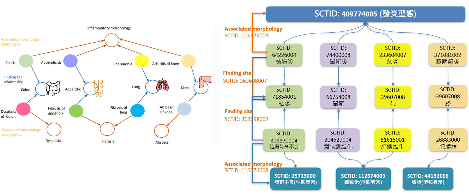 SCT visual example